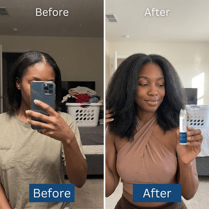 LOVILDS Hair Growth Roll on Serum