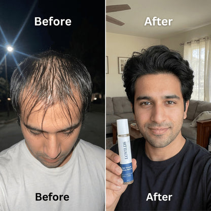 LOVILDS Hair Growth Roll on Serum