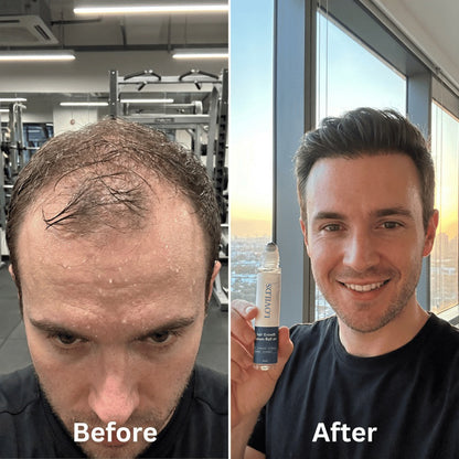 LOVILDS Hair Growth Roll on Serum