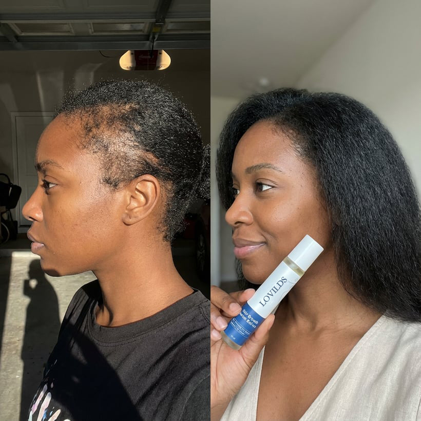 LOVILDS Hair Growth Roll on Serum
