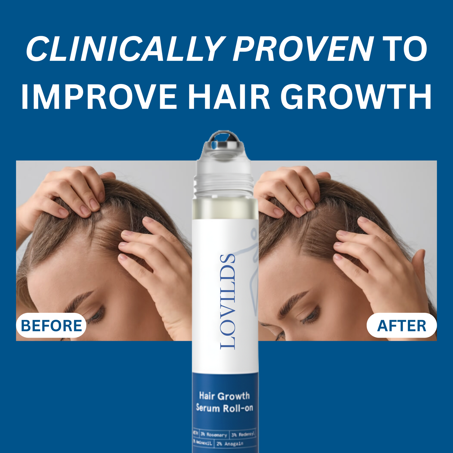 LOVILDS Hair Growth Roll on Serum