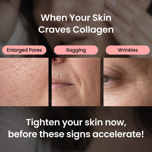 Lunaraé™Collagen Gel Mask